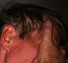 man hiding face